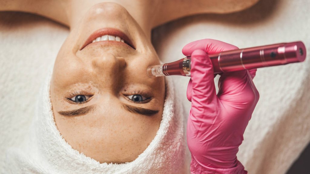 Jakie efekty daje Dermapen? Jakie efekty daje Dermapen?