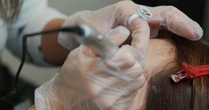 Ile utrzymuje się efekt Dermapen