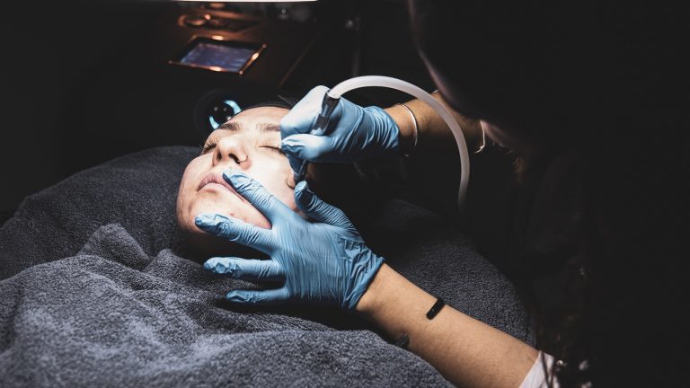 Kwas hialuronowy na usta – jak długo się utrzymuje?